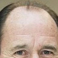 GeorgeGrahamsForehead